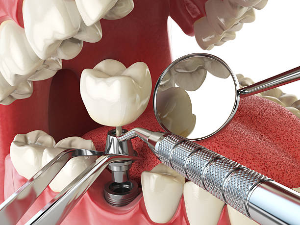 Best Emergency Dental Services for Seniors in Bryan, TX